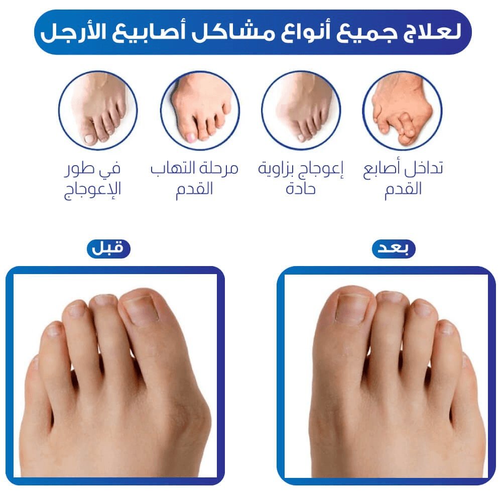 مصحح القدم الجديد "FeelGreat" - Makfool