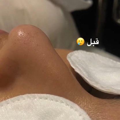 جهاز الهيدرافيشل المنزلي ذو التنظيف العميق - Makfool