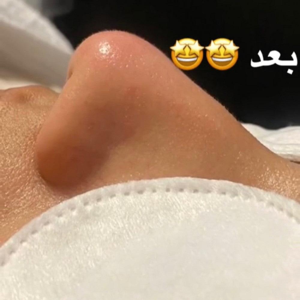 جهاز الهيدرافيشل المنزلي ذو التنظيف العميق - Makfool