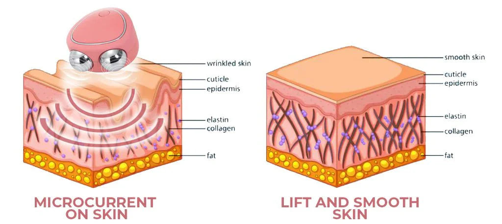 جهاز مساج بتقنية مكركرنت لتحفيز الكولاجين وشد البشرة - Makfool