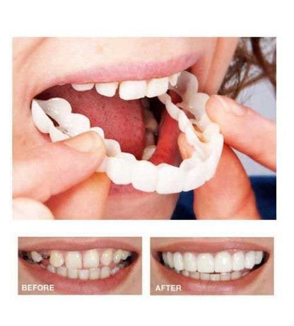 SNAP ON SMILE™ إبتسامة هوليود الأصليه