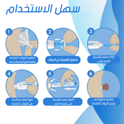 قلم ازالة الثآليل والزوائد الجلدية الأكثر مبيعا في المملكة -- أطلب واحد وأحصل على الثاني مجانا